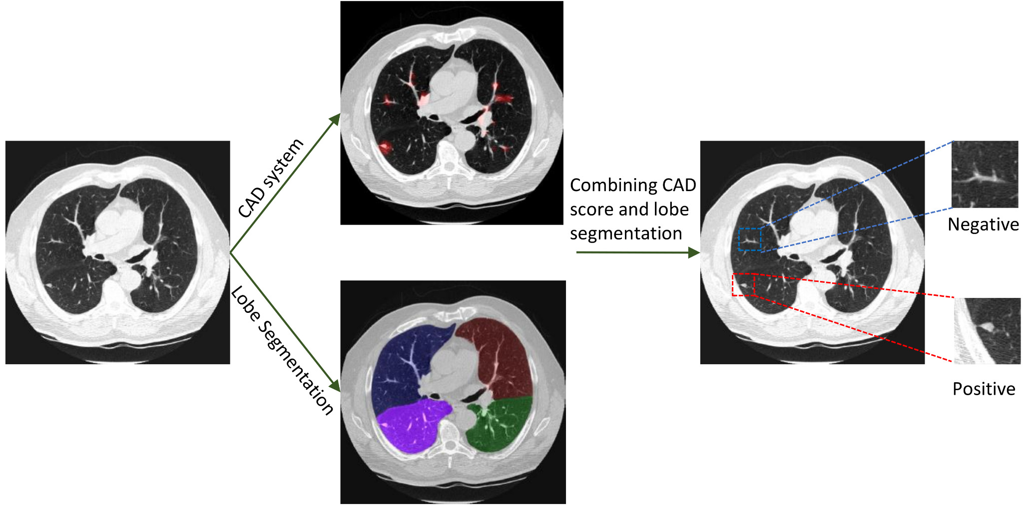 Semi-Supervised Training using Cooperative Labeling of Weakly Annotated Data for Nodule Detection in Chest CT